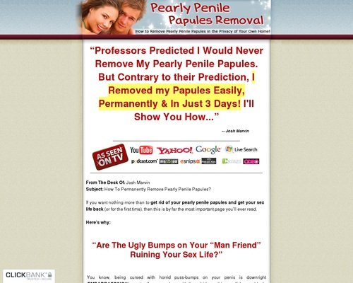 Pearly Penile Papules Removing – How one can Take away Pearly Panile Papules at Dwelling Pearly Penile Papules Removing – How one can Take away Pearly Panile Papules at Dwelling