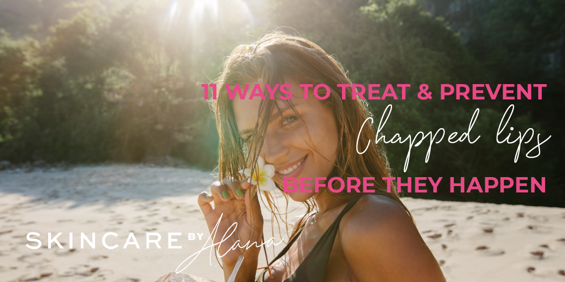 Chapped Lips Therapies | Prevention and Residence Cures