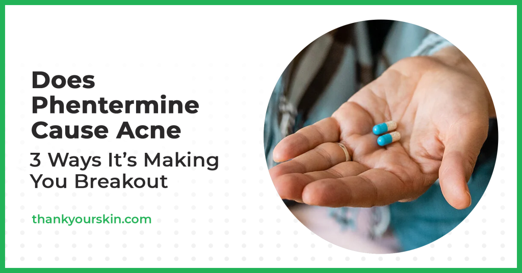 Does Phentermine Trigger Zits? (A Should-Learn!)
