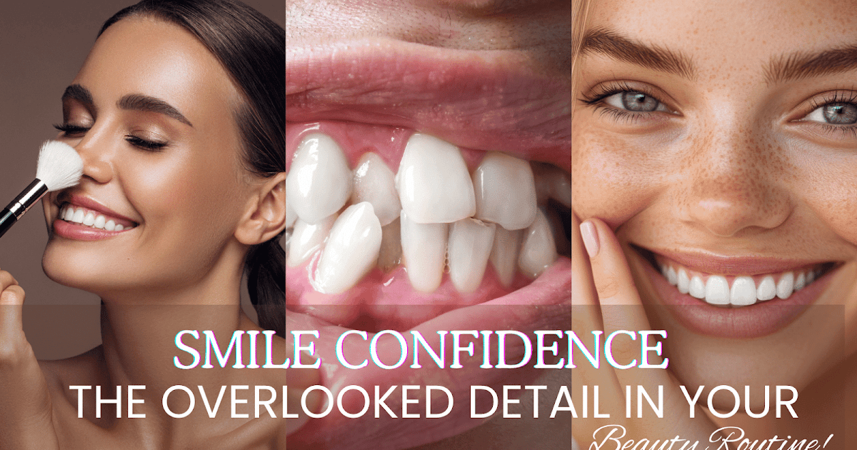Smile Confidence: The Neglected Element in Your Magnificence Routine